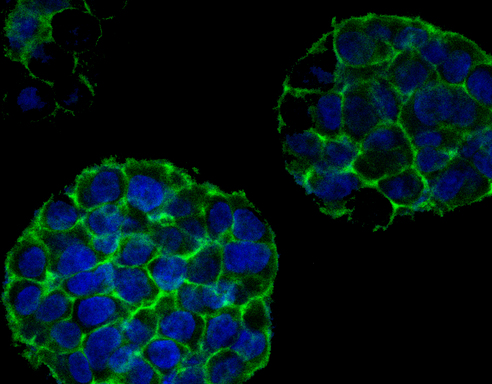 3-D printed tumor cells will imitate cancer cells to aid research 