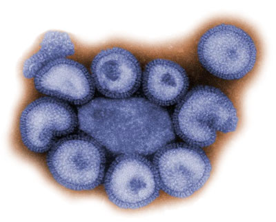 Virus Support on The Dreaded Ah1n1 Flu Virus Has Less Affect On Elderly People  It Is