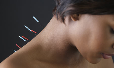 Acupuncture and natural painkillers