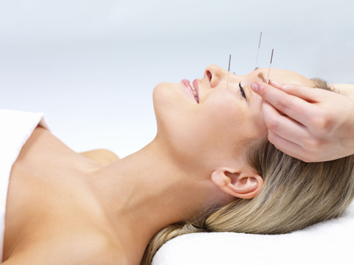 Acupuncture_3 Jpg