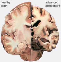 How to boost Alzheimer''s-fighting compounds’ value