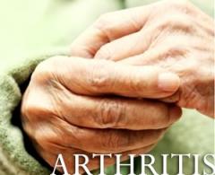 Charity warns over rising level of arthritis in the UK