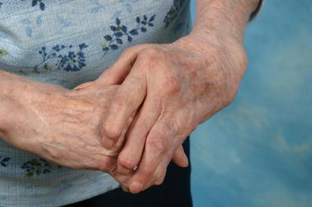 How fish oils help fight arthritis