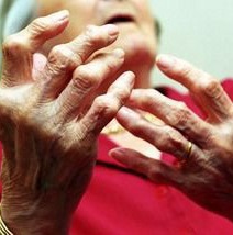 Arthritis-patients