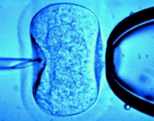 Autism and vitro fertilization may have close link