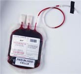 Blood Transfusion