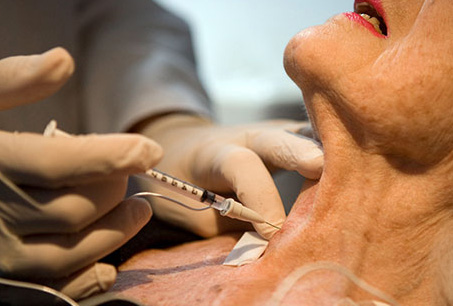 Botox injections into the vocal cords proven to help asthma patients