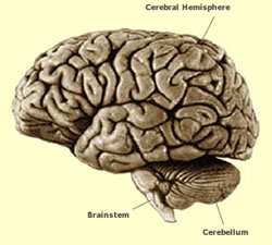 Brain tumours in childhood cast a long shadow on survivors