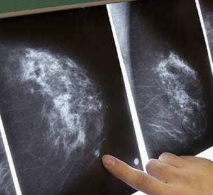 Breast-Cancer-Treatments
