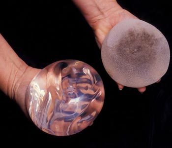 European Commission calls for reforms amid ‘implants’ case