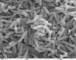 Two Test Positive For Cholera In Bandra