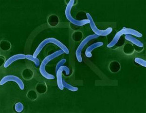 Cholera Spreads To East Sepik