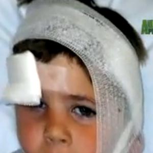 Teenage Canadian girl survives coyote attack