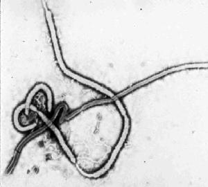 Ebola virus