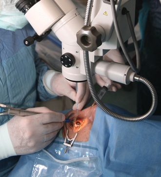 Eye surgeons oppose rationing of cataract operations