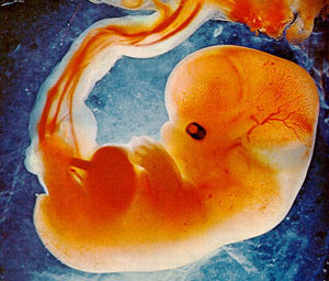 Scientists give evolutionary explanation for fertility problems