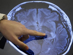 'Free will' may stem from brain noise