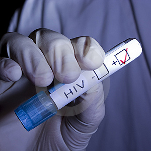 HIV Positive Cases Going Up In Madurai 