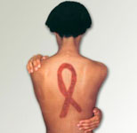 HIV/AIDS