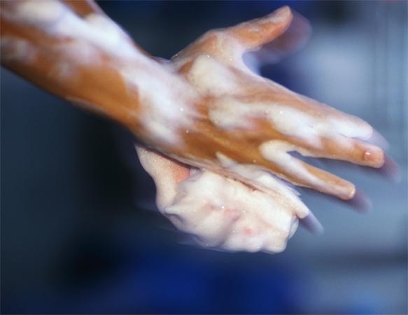 Handwashing may be best way to fight MRSA