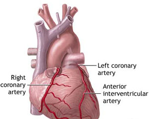 Scientists to target immune cells in arteries to prevent heart attacks