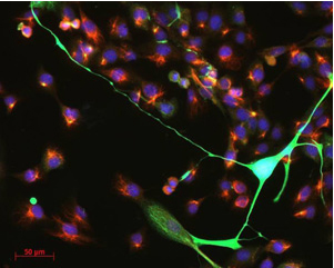 Human breast milk contains stem cells