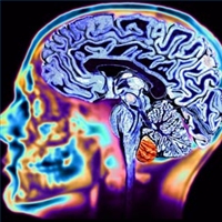 Cause of damage from Huntington’s disease ‘discovered’