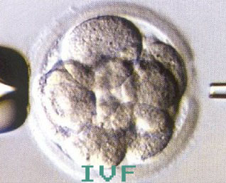 IVF procedures pose risk to mothers and babies, experts