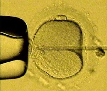 Stress, hectic lifestyle raises IVF demand