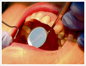 Irsih dentists warned dental treatment abroad can lead to more problems 