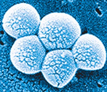 About two millions cancers caused by infections worldwide, study