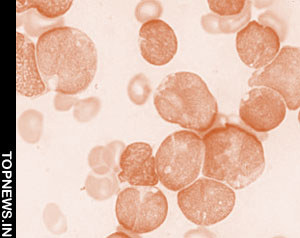 Biphosphonates may prevent radiation-induced leukaemia