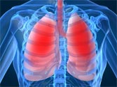 Lung disease increase risk of heart attack