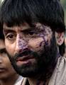 Muhammad Yasin Malik