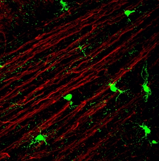 NG2-cells