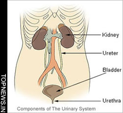 Novel device may help with bladder control