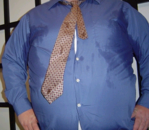 Obese teens have high risk of psoriatic arthritis