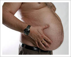 Obesity ‘ups prostate cancer recurrence risk’