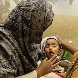 100 measles deaths in 2013... and counting in Pakistan