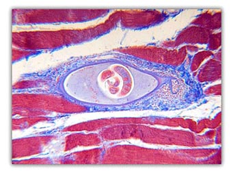 Blocking parasites in host cell may provide new way to fight malaria