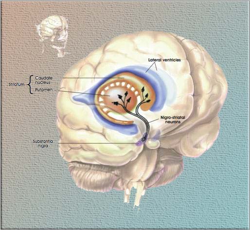 Stem cell may offer hope of curing Parkinson’s