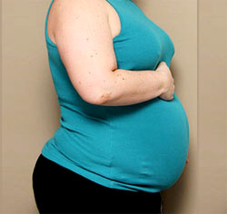 Extra pregnancy pounds could pose problems for obese women