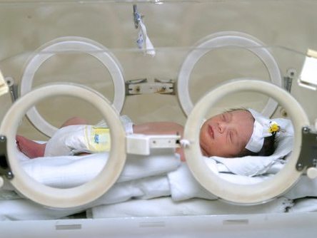 Psych disorder risk is increased by extreme preterm