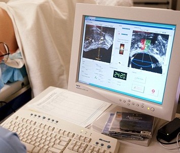 Researchers test new prostate cancer treatment with lesser side effects