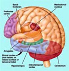 Schizophrenia linked to diabetes