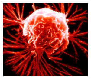 What makes skin cancer grow