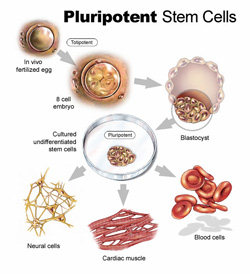 Your own stem cells can treat cardiac disease