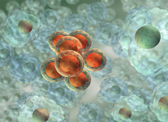 Stem cell breakthrough explains how breast cancer spreads
