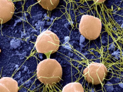 Large hospitals are breeding grounds for superbug MRSA, study