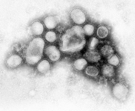Swine Flu